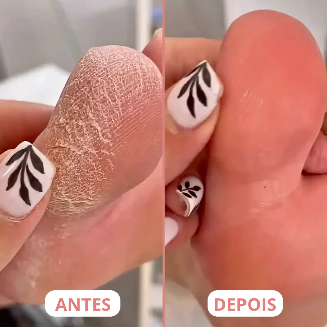 🌟 PédiBrilho + 60 discos: Pés macios, suaves e irresistíveis em poucos minutos! 👣✨